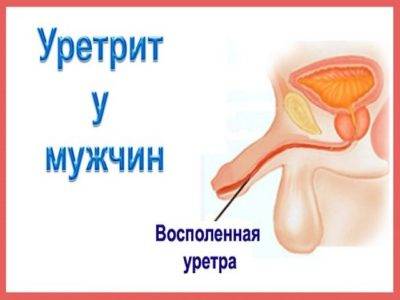 Антибіотики при уретриті і циститі у чоловіків