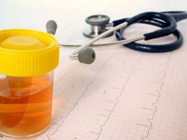 Чи можна вилікувати цистит не антибіотиками Чи можна вилікувати цистит не антибіотиками