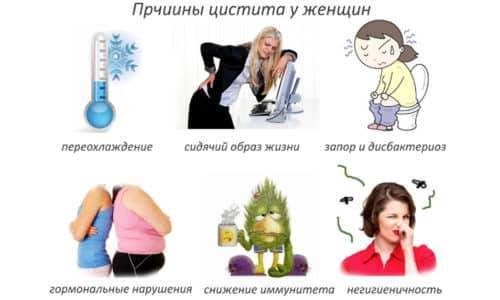 Чи можна завагітніти при хронічному циститі: впливає і на зачаття і вагітність 2019