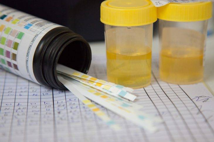 Чим і як лікувати цистит при цукровому діабеті Чим і як лікувати цистит при цукровому діабеті