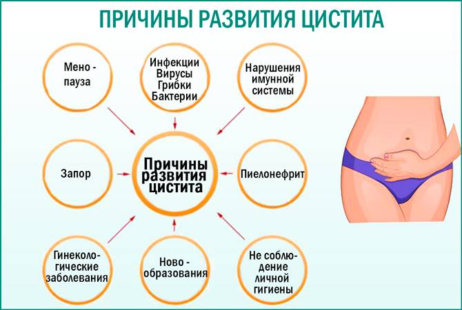 Цифран при лікуванні циститу у жінок плюси і мінуси препарату