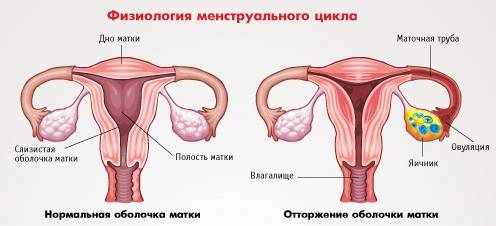 Цистит місячні кров – Цистит