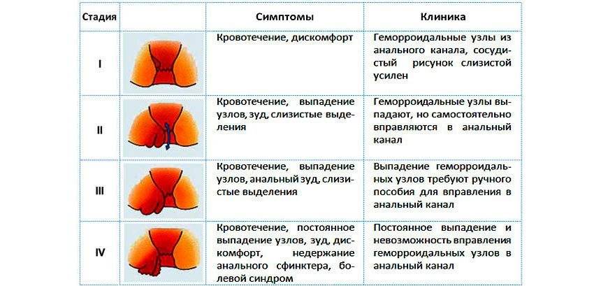 Цистит на ранніх стадіях як лікувати