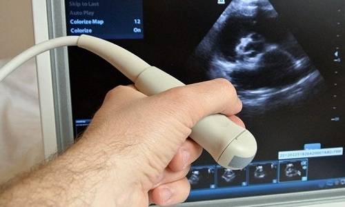 Цистит не проходить після антибіотиків: чому, що робити (аналізи, лікування) Цистит не проходить після антибіотиків: чому, що робити (аналізи, лікування)