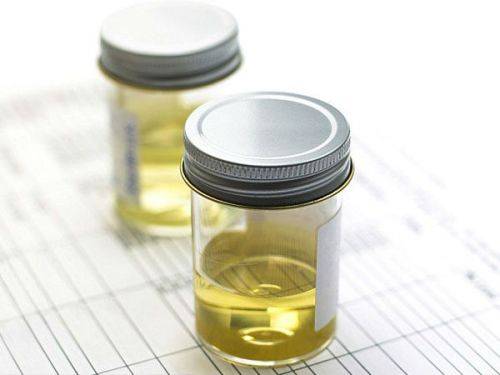 Цистит при грудному вигодовуванні причини виникнення і лікування