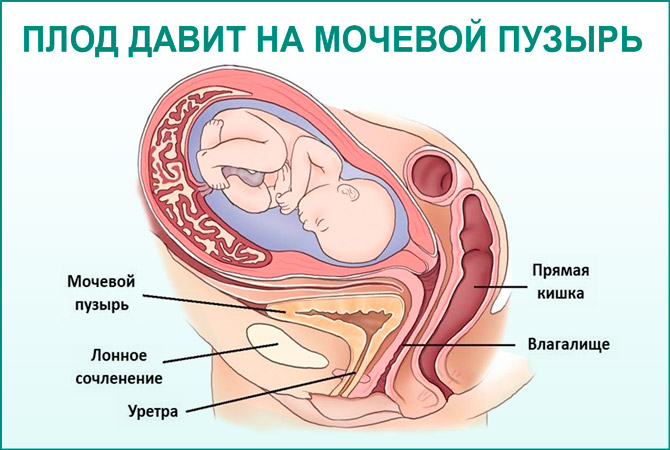 Цистит при вагітності лікування на ранніх термінах, симптоми захворювання, як і чим лікувати на пізніх термінах