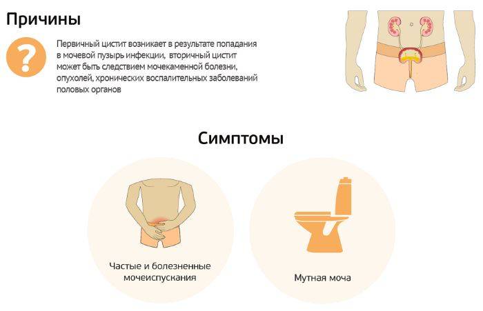 Цистит у чоловіків — лікування, харчування