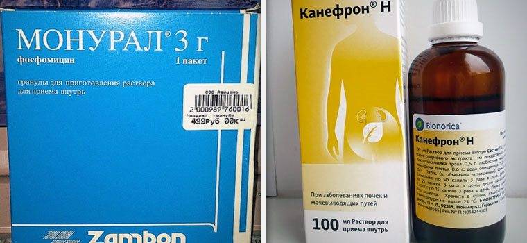 Цистит у дітей Що робити і як лікувати