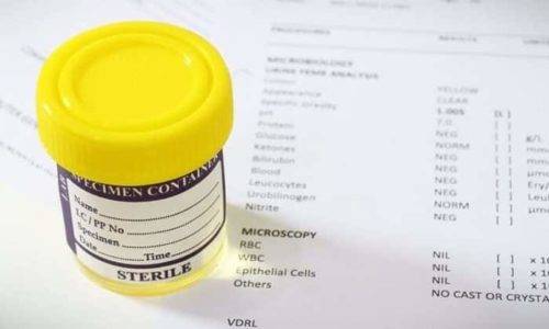 Цистит у першому триместрі вагітності Цистит у першому триместрі вагітності