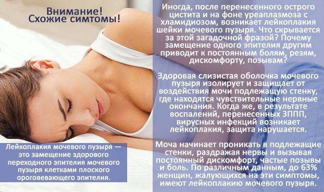 Цистит у жінок – причини, симптоми, діагностика та лікування Цистит у жінок – причини, симптоми, діагностика та лікування
