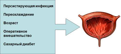 Цистит у жінок – причини, симптоми, діагностика та лікування