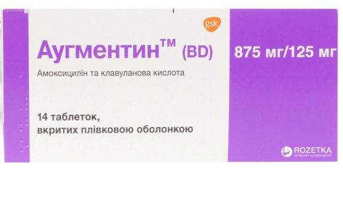 Цистит, уретрит у жінок – причини, відмінності, симптоми і лікування Цистит, уретрит у жінок – причини, відмінності, симптоми і лікування