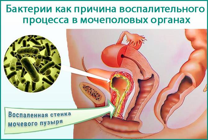 Цистит з появою крові під час сечовипускання