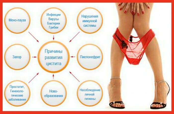 Цистит з появою крові під час сечовипускання Цистит з появою крові під час сечовипускання