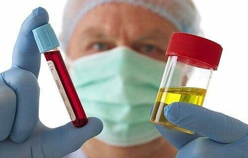 Цистит з появою крові під час сечовипускання Цистит з появою крові під час сечовипускання