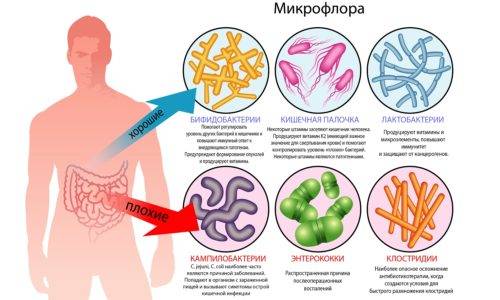 Цистит заразний чи ні – Все про урології