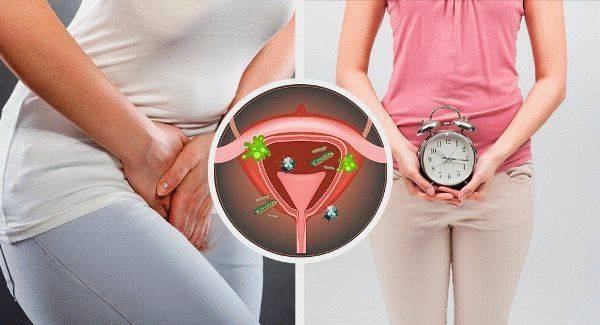 Цистит і затримка місячних є взаємозв’язок