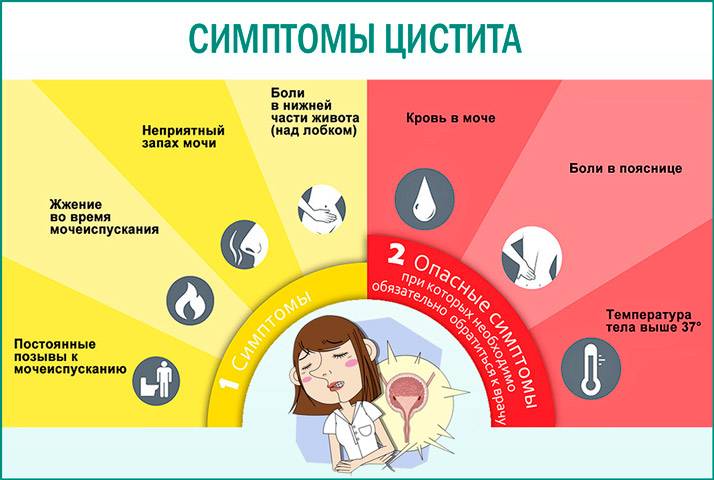 До якого лікаря звертатися при циститі жінці