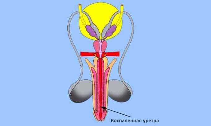 Допомагає при циститі бруснивер?