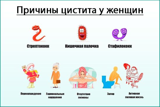 Хронічний цистит: клінічні особливості та лікування. Хронічний цистит у жінок: симптоми та методи лікування