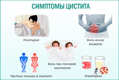 Хронічний цистит: клінічні особливості та лікування. Хронічний цистит у жінок: симптоми та методи лікування