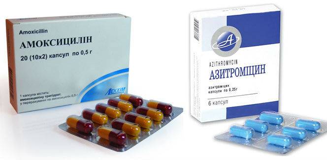 Коли призначають антибіотики при циститі Коли призначають антибіотики при циститі