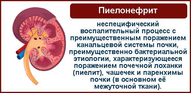 Лікування циститів і сечокам’яної хвороби лікарськими рослинами.