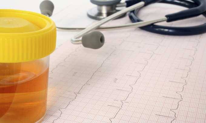 Може бути цистит від сексу ? Секс при циститі