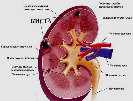 Чи можна захворіти циститом від переохолодження