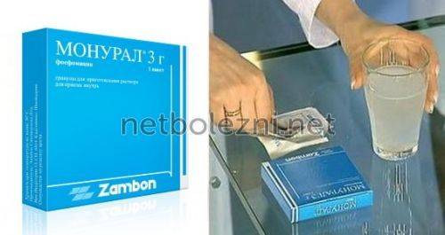 Найбільш ефективні ліки від циститу для дітей