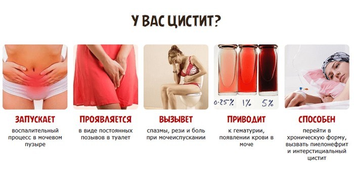 Індометацин (свічки) при циститі – інструкція із застосування, відгуки, аналоги, форма випуску, побічні дії, протипоказання, ціна