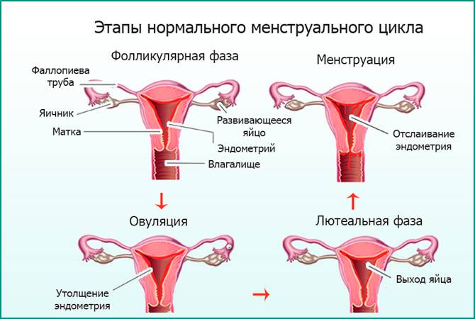 Негативний вплив циститу на місячні