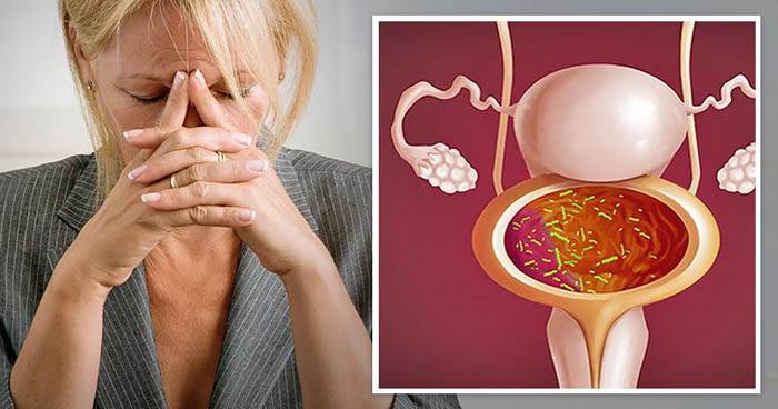 Нервовий цистит: симптоми, причини, лікування