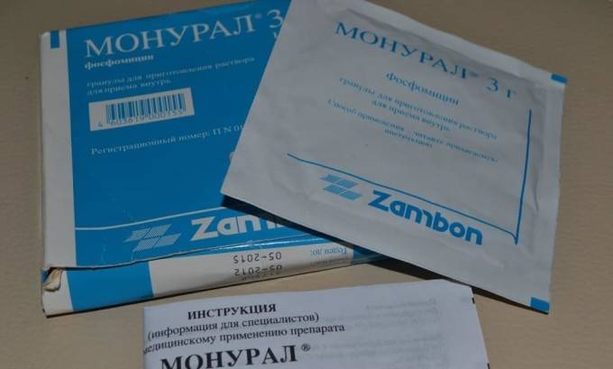 Особливості лікування циститу різними методами