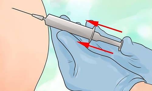 Показання та спосіб застосування Амікацину при циститі