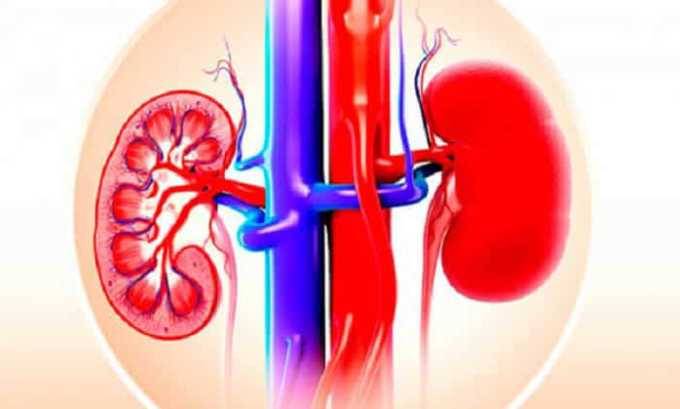 Показання та спосіб застосування Амікацину при циститі