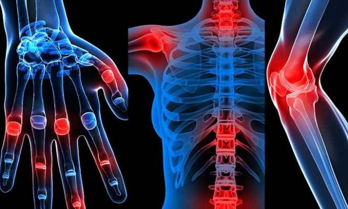 Показання та спосіб застосування Амікацину при циститі