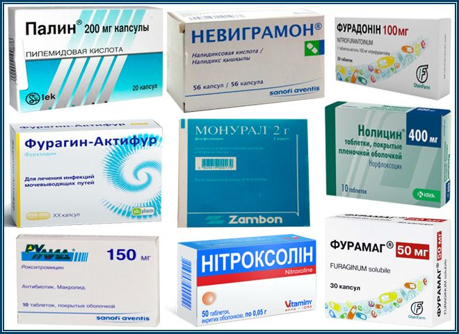 Препарати від циститу: лікування у жінок і чоловіків, недорогі та ефективні протизапальні, антибактеріальні, рослинні Препарати від циститу: лікування у жінок і чоловіків, недорогі та ефективні протизапальні, антибактеріальні, рослинні