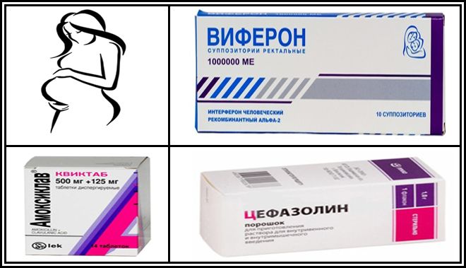 Препарати від циститу: лікування у жінок і чоловіків, недорогі та ефективні протизапальні, антибактеріальні, рослинні Препарати від циститу: лікування у жінок і чоловіків, недорогі та ефективні протизапальні, антибактеріальні, рослинні