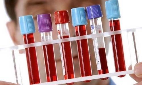 Причини захворювання геморагічним циститом