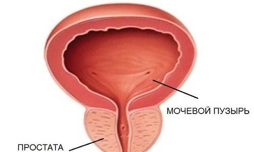 Причини захворювання геморагічним циститом