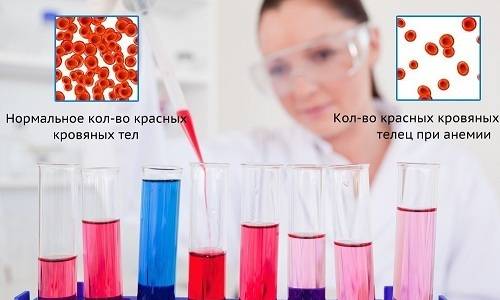 Причини захворювання геморагічним циститом