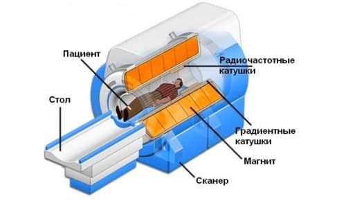 Променевий цистит у жінок після радіаційної терапії (променевої терапії): симптоми і лікування захворювання, можливі ускладнення та профілактика Променевий цистит у жінок після радіаційної терапії (променевої терапії): симптоми і лікування захворювання, можливі ускладнення та профілактика