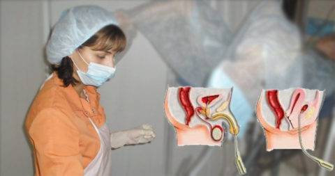 Ромашка від циститу допомагає швидко і ефективно Ромашка від циститу допомагає швидко і ефективно