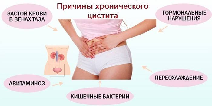 Що таке цистит, чому він виникає і як його лікують?