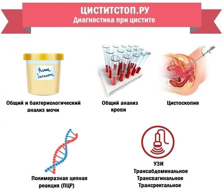 scho take deflorac yniy cistit cistit 5 - Що таке дефлораційний цистит Цистит