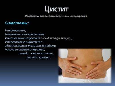 Швидка допомога при циститі препарати і процедури, які знімуть біль