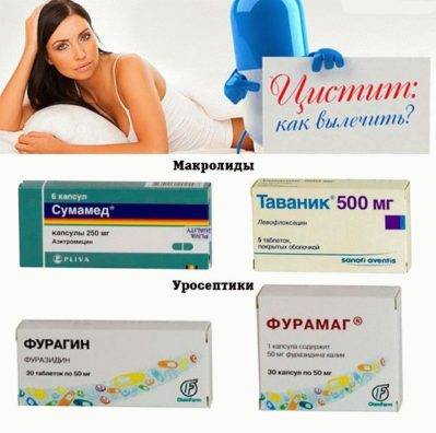 Швидка допомога при циститі препарати і процедури, які знімуть біль