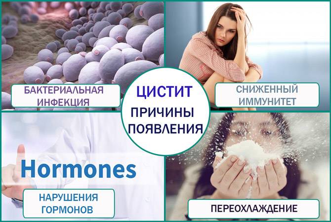 Таблетки Флемоклав при циститі запобіжні заходи і рекомендації