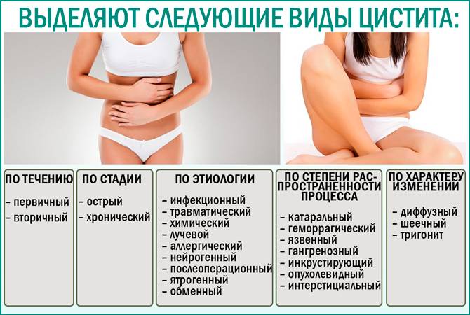 Трихопол при циститі: як приймати і пити (відгуки) 2019